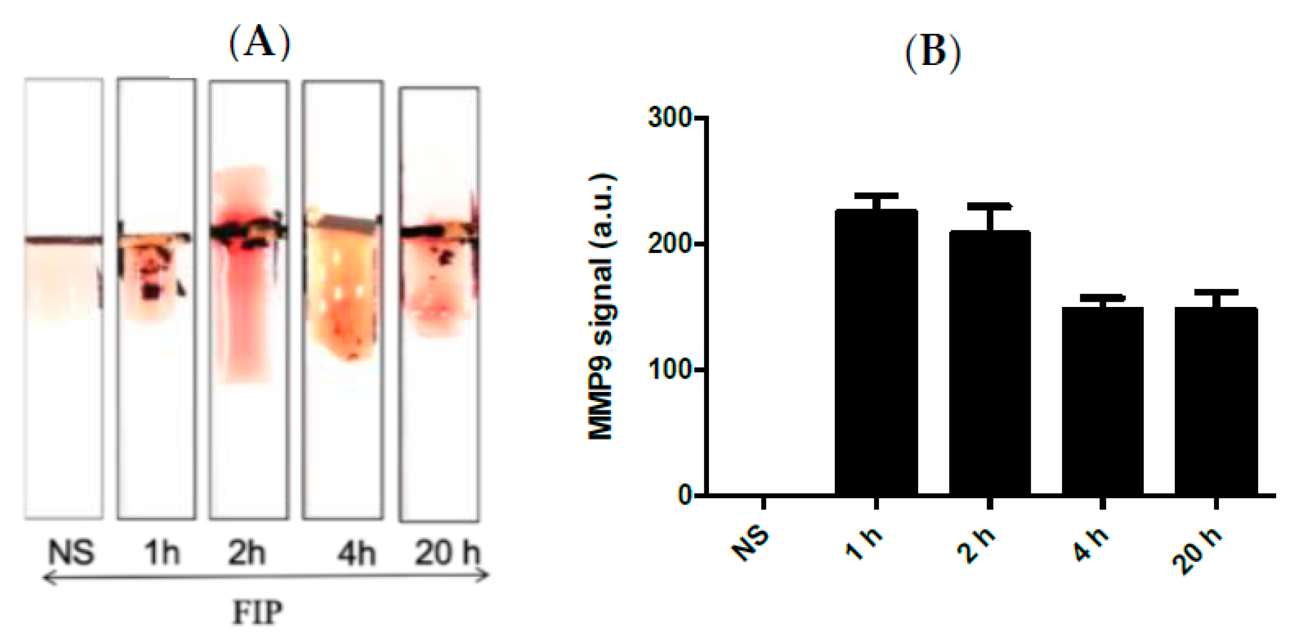 Biosensors 13 00804 g004 Biosensors 13 00804 g004