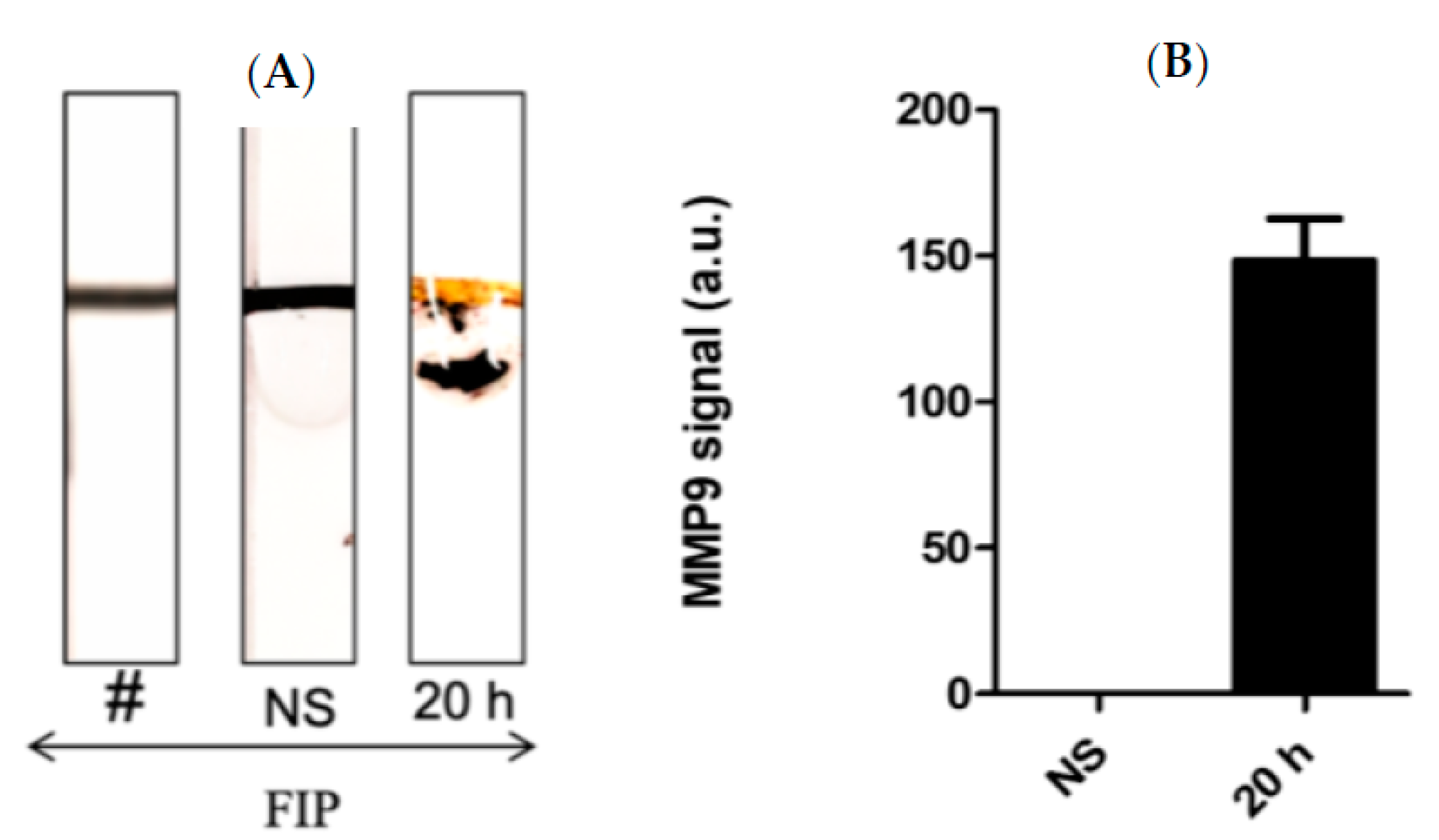 Biosensors 13 00804 g005 Biosensors 13 00804 g005
