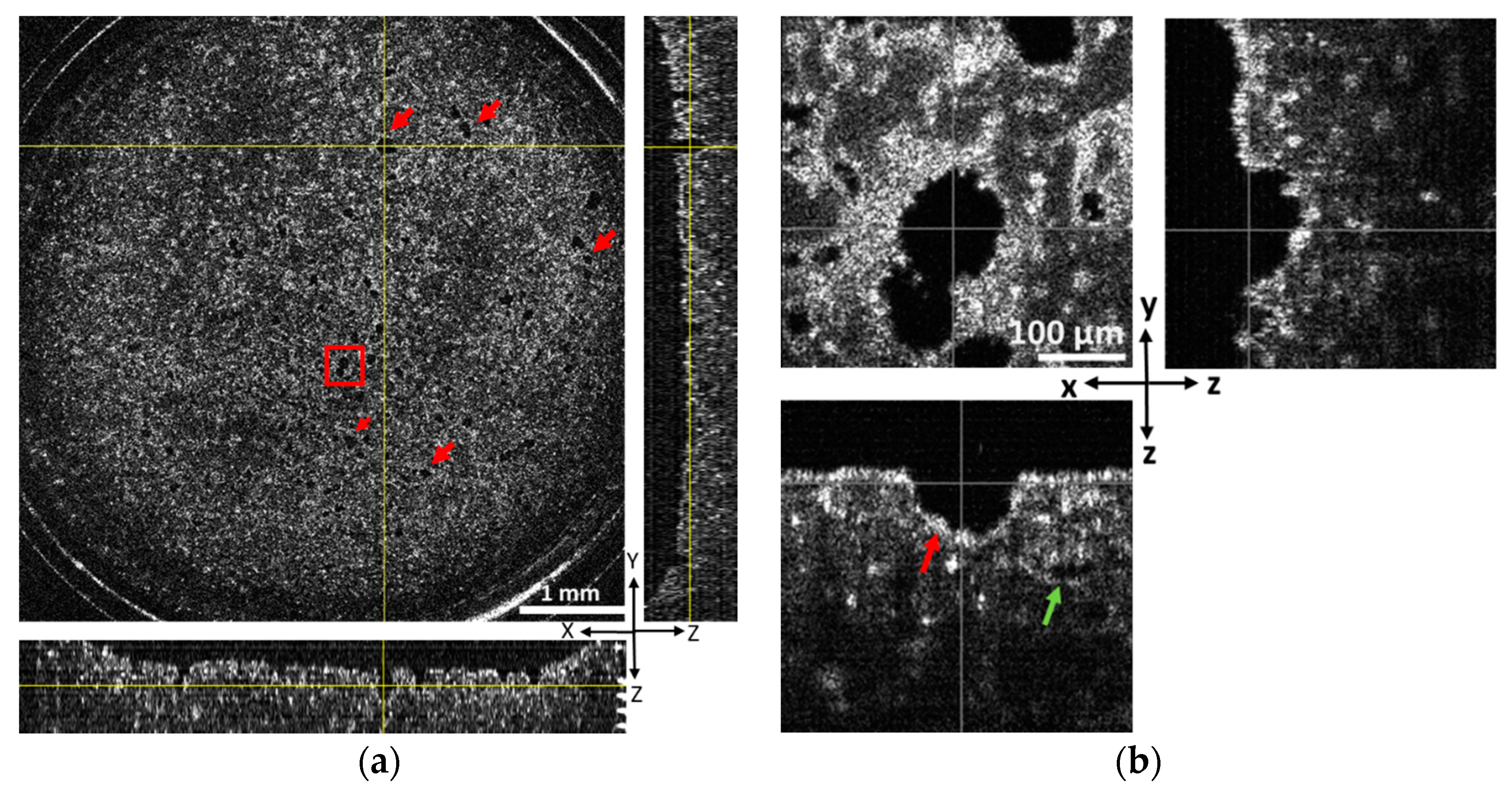 Biosensors 13 00818 g002 Biosensors 13 00818 g002