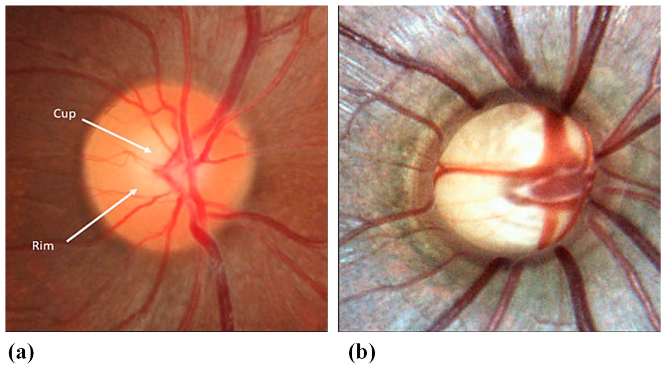 Biosensors 13 00933 g006