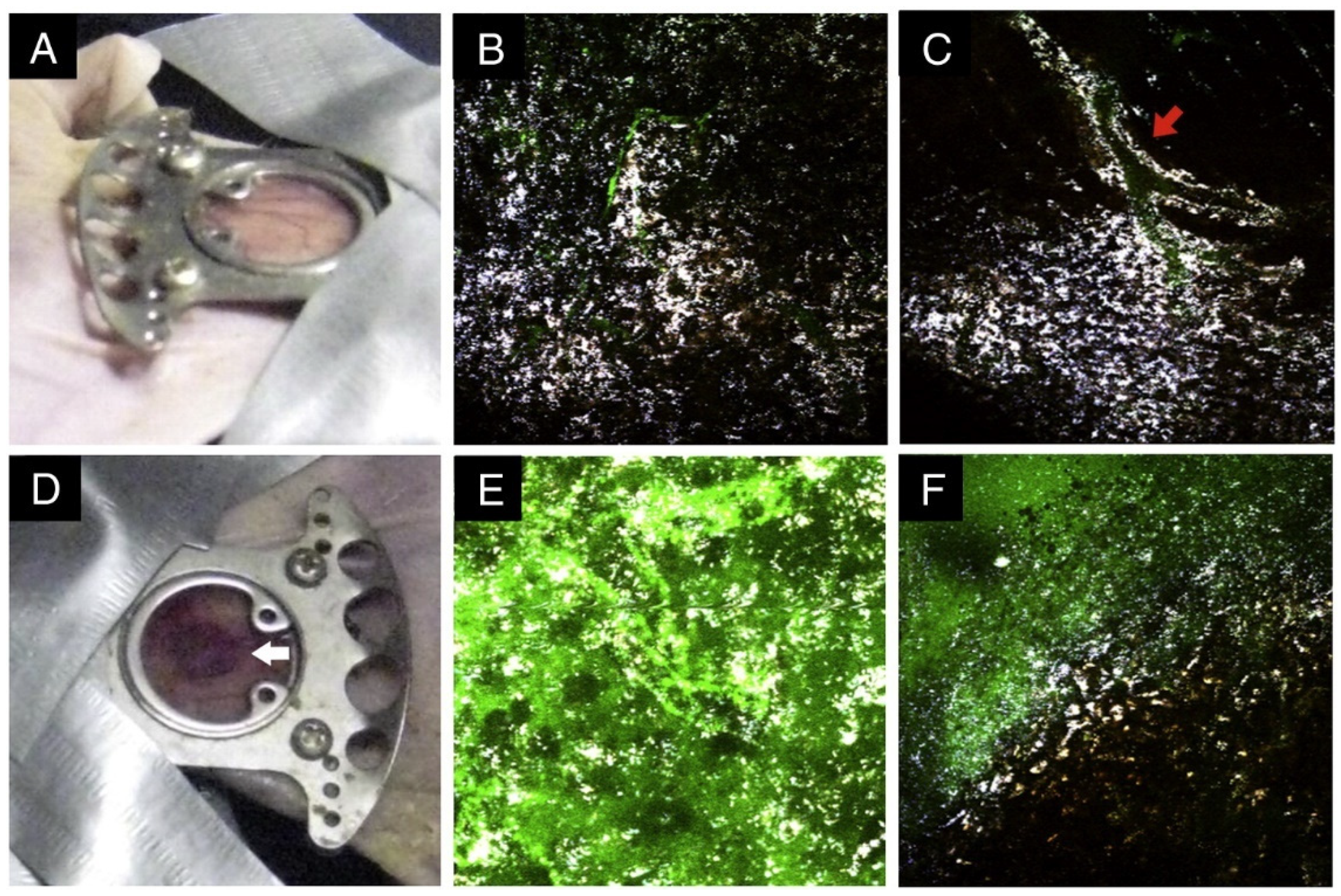 Biosensors 13 00977 g013