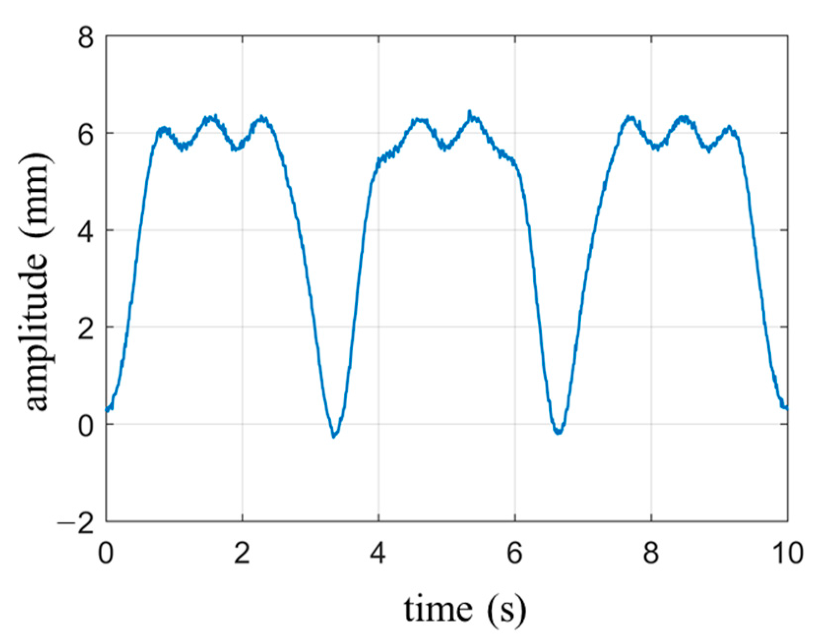 Biosensors 13 00982 g004