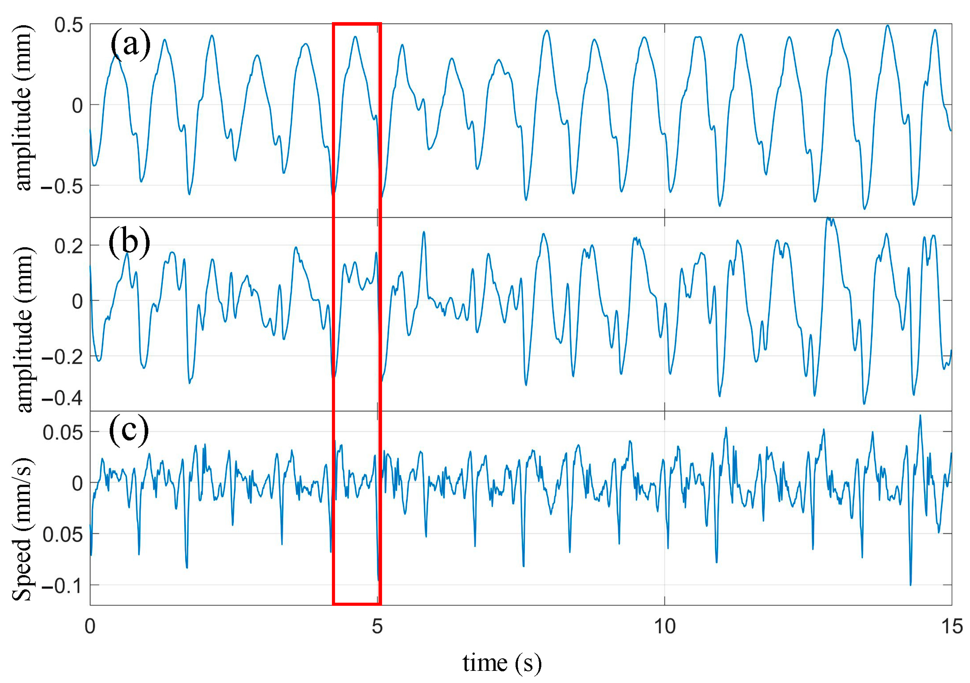 Biosensors 13 00982 g012