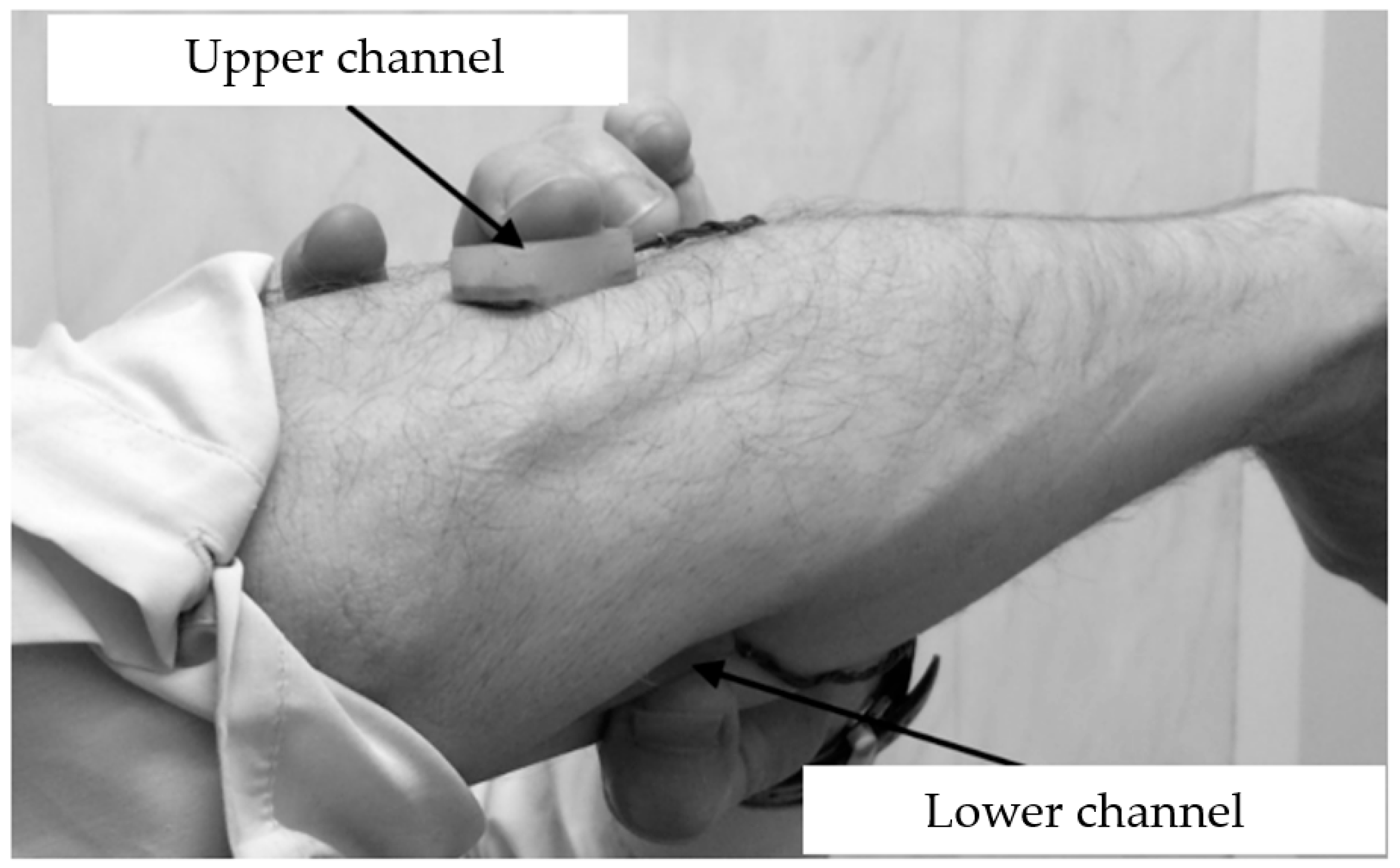Biosensors 14 00076 g002