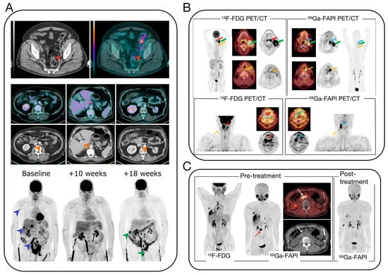 Biosensors 14 00100 g002