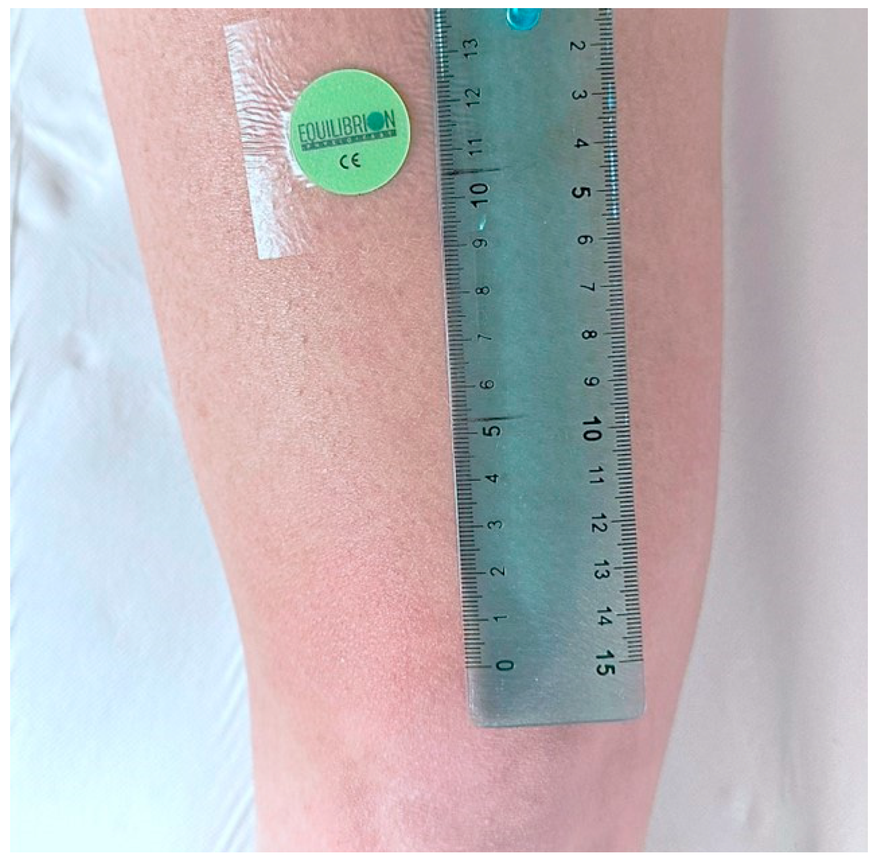 Biosensors 14 00354 g001