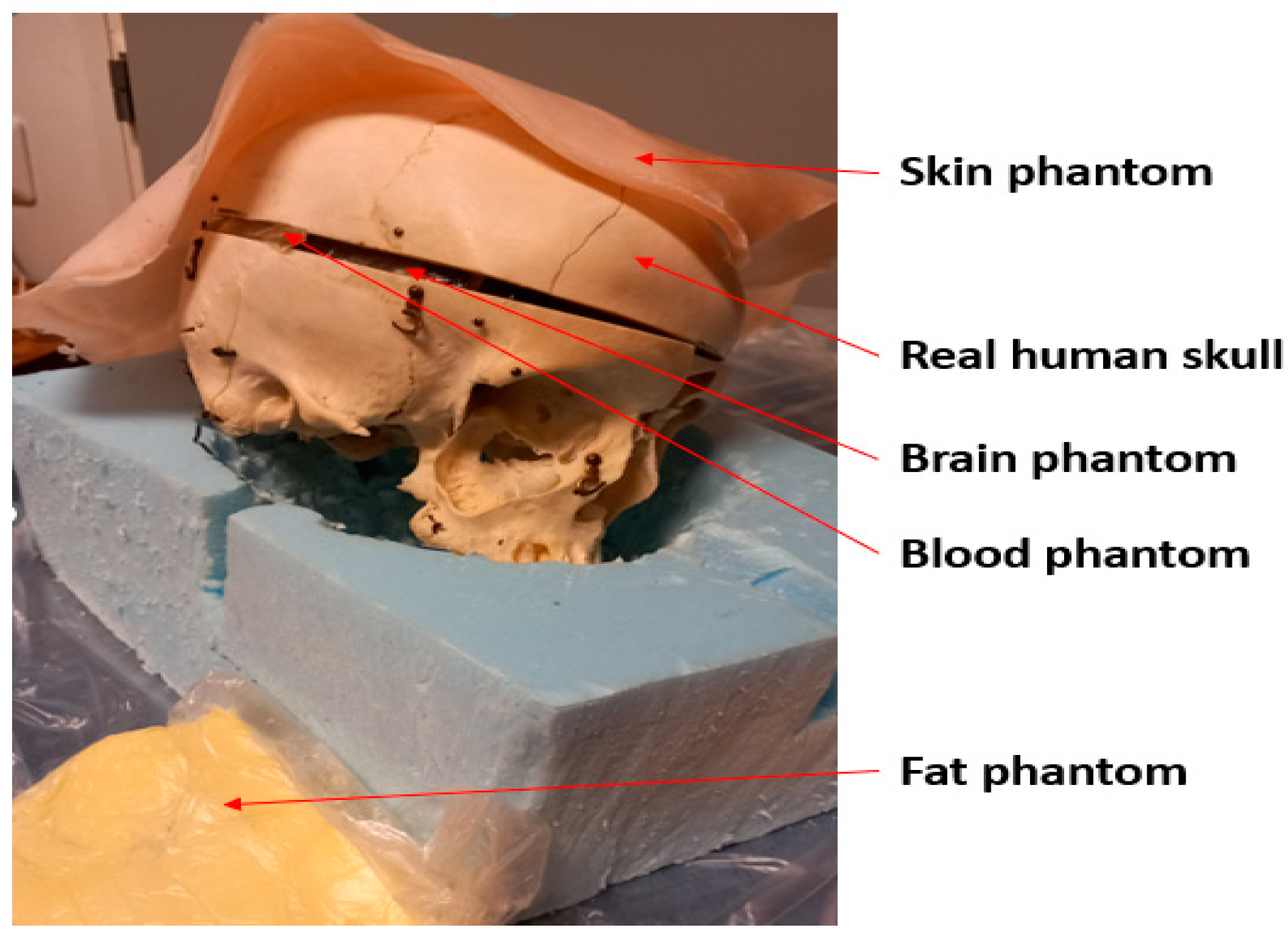 Biosensors 14 00434 g004 Biosensors 14 00434 g004