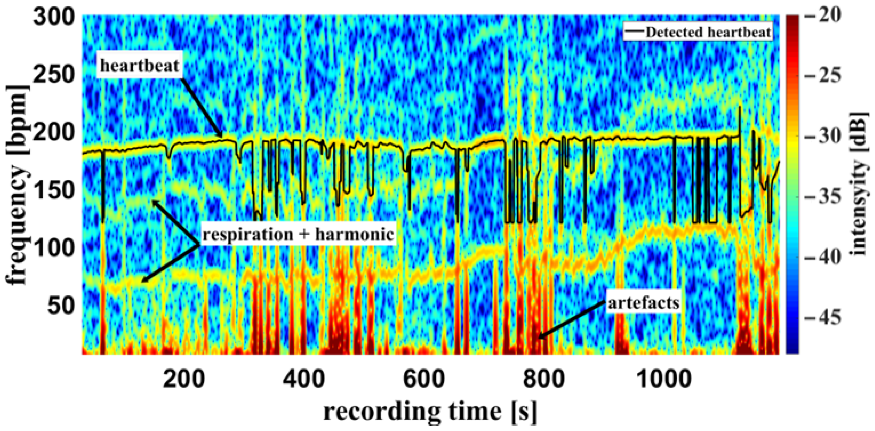 Biosensors 14 00437 g011