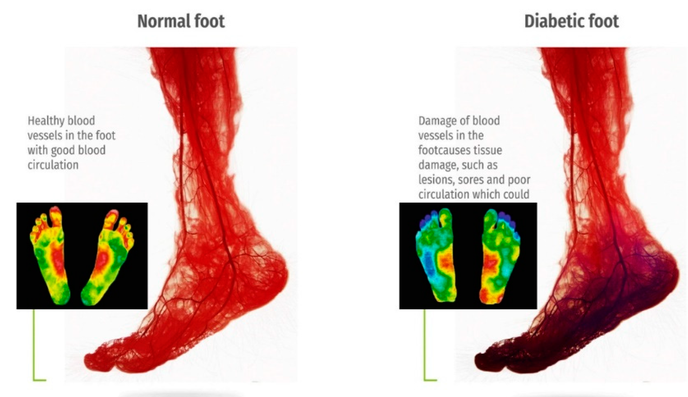 Biosensors 14 00614 g002
