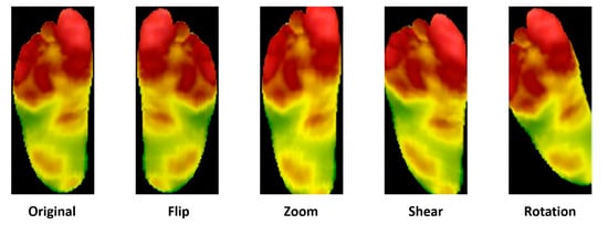 Biosensors 14 00614 g004