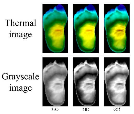 Biosensors 14 00614 g008