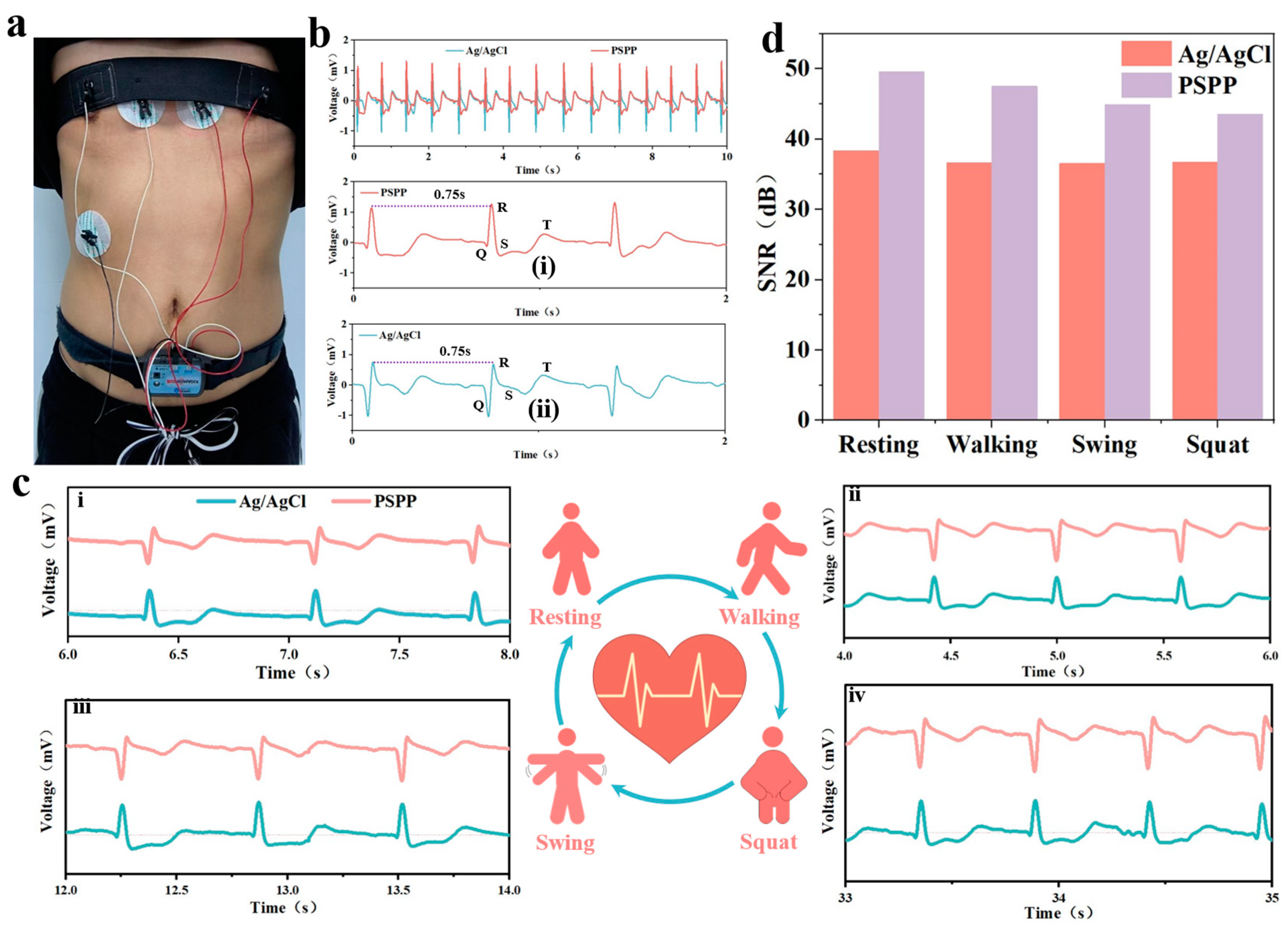 Biosensors 15 00177 g007