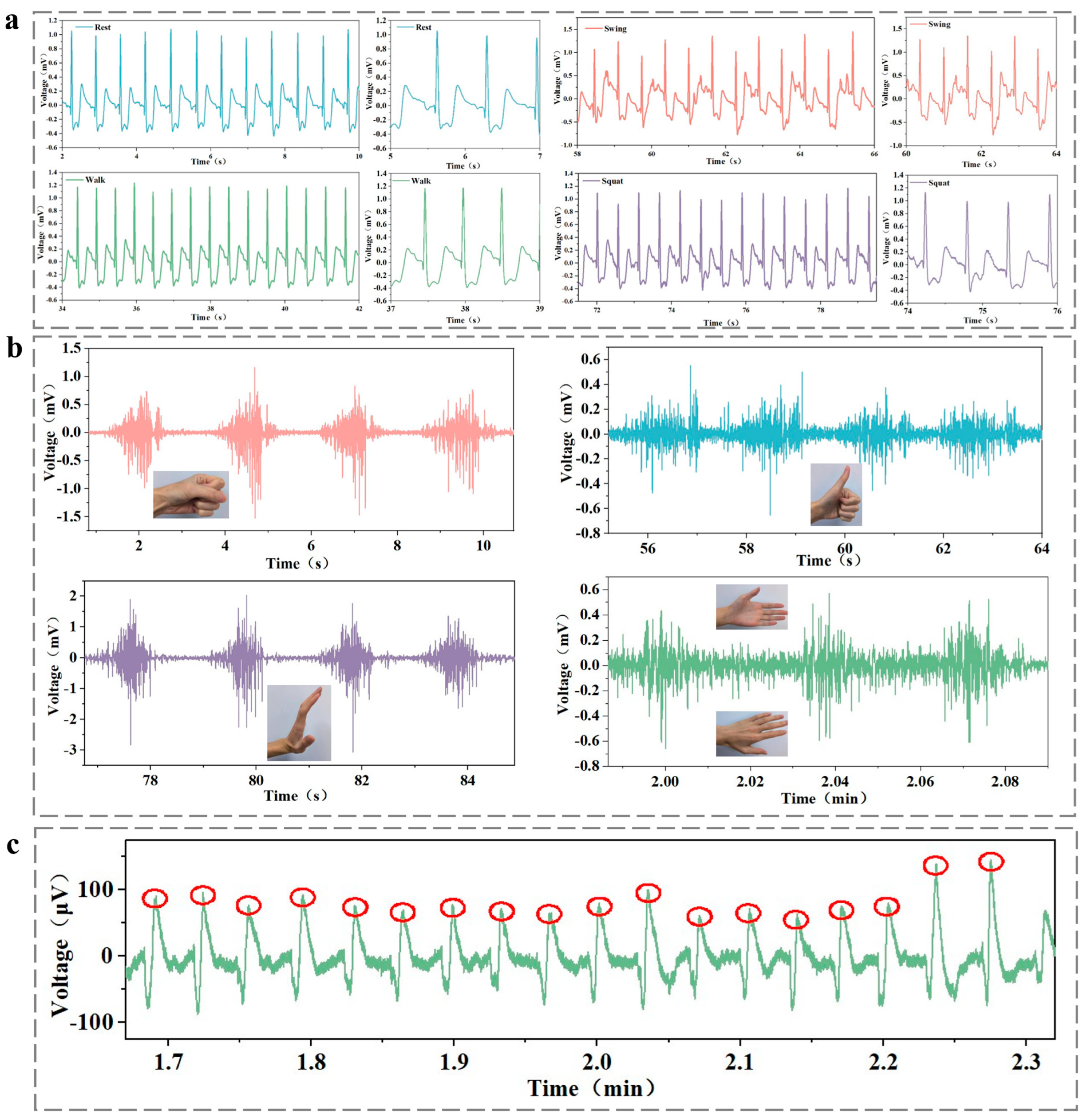 Biosensors 15 00177 g009