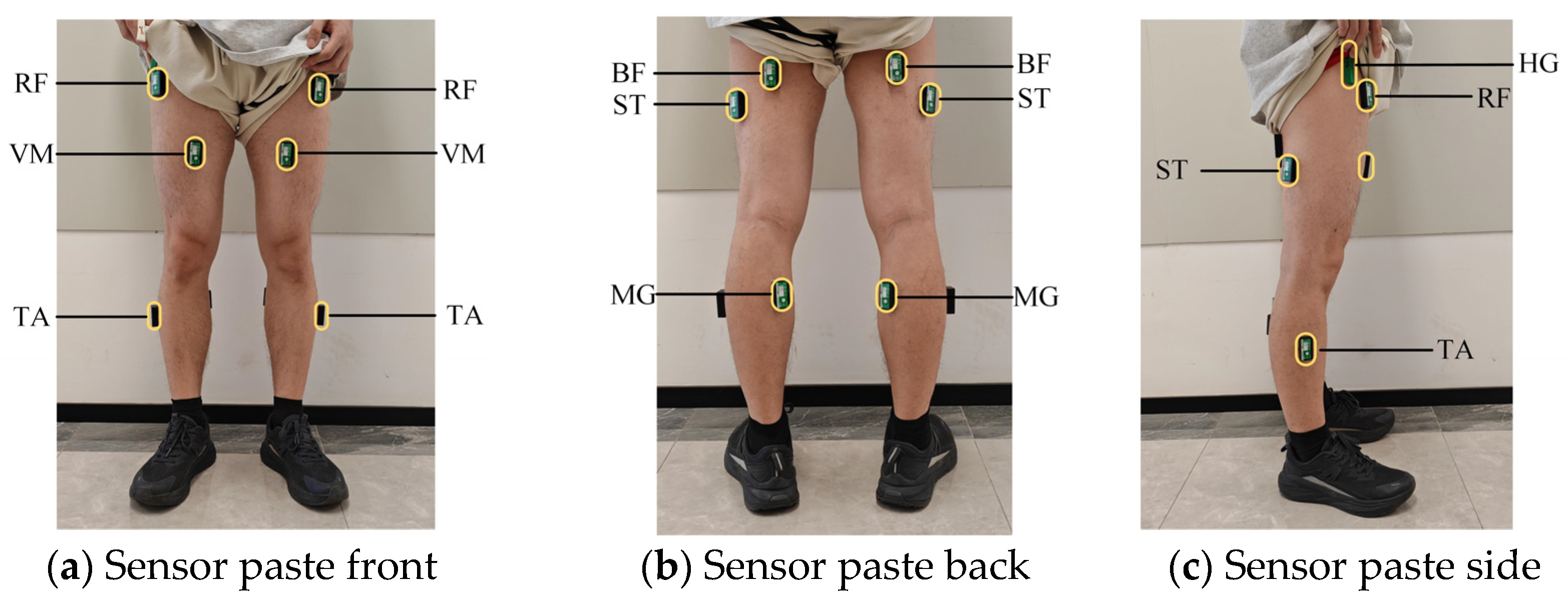 Biosensors 15 00305 g002