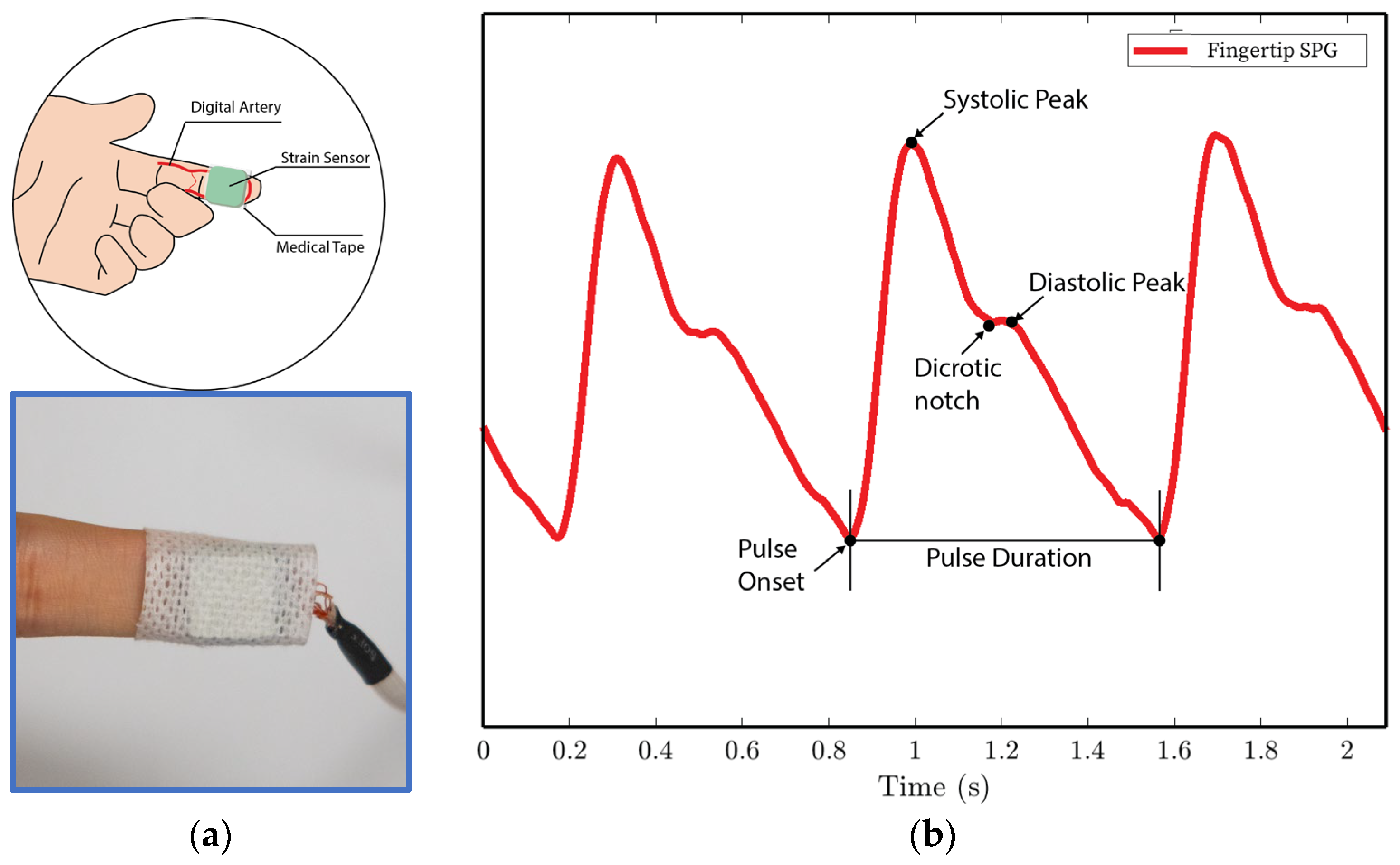 Biosensors 15 00325 g010