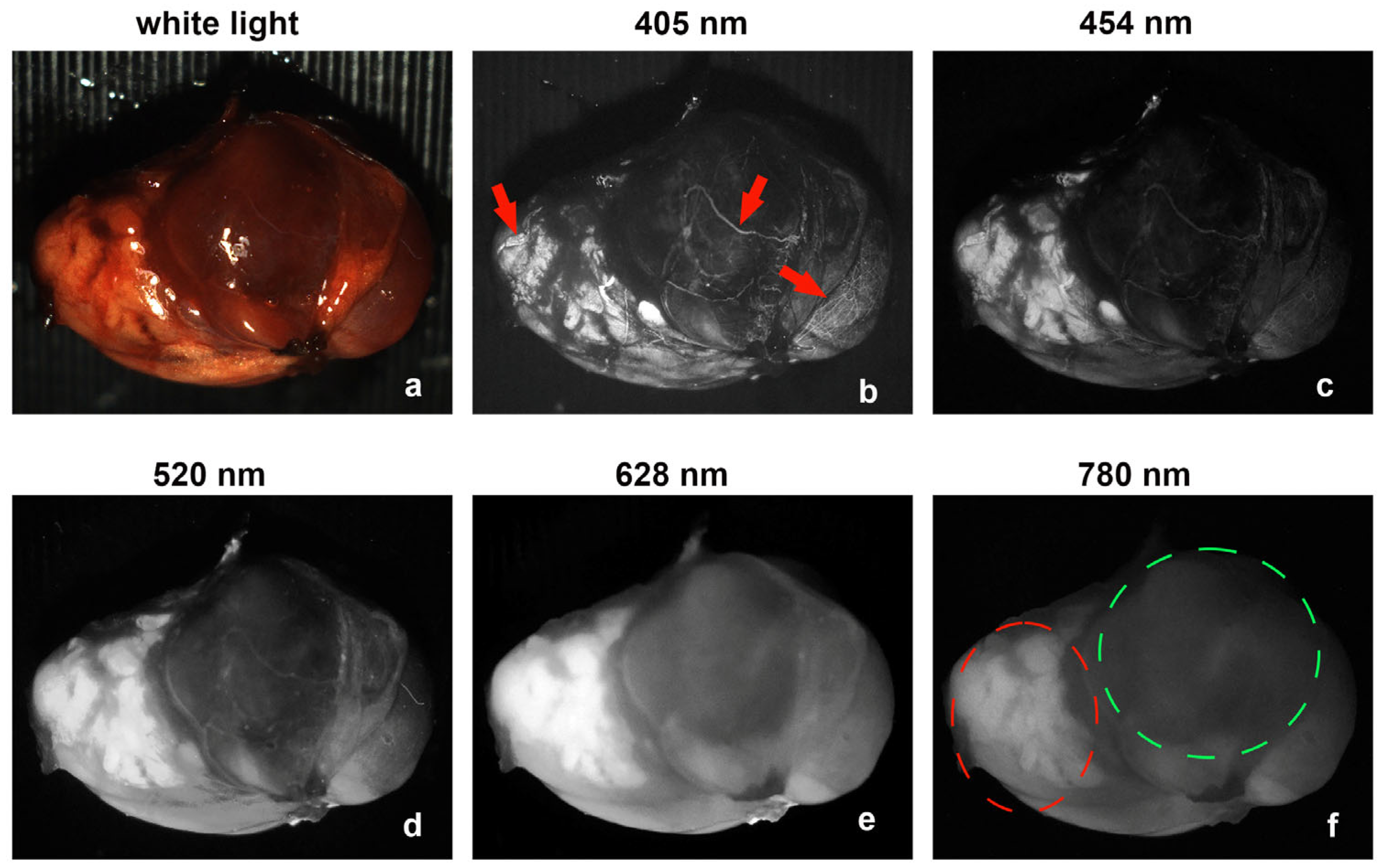 Biosensors 15 00352 g004