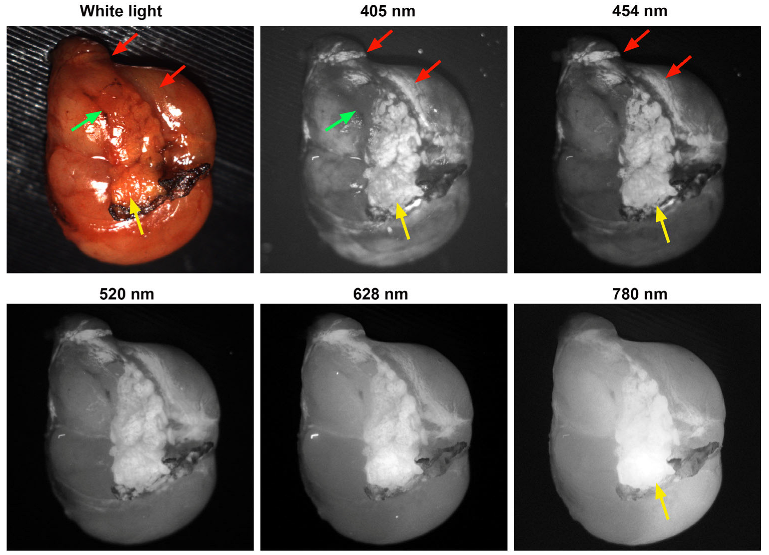 Biosensors 15 00352 g005