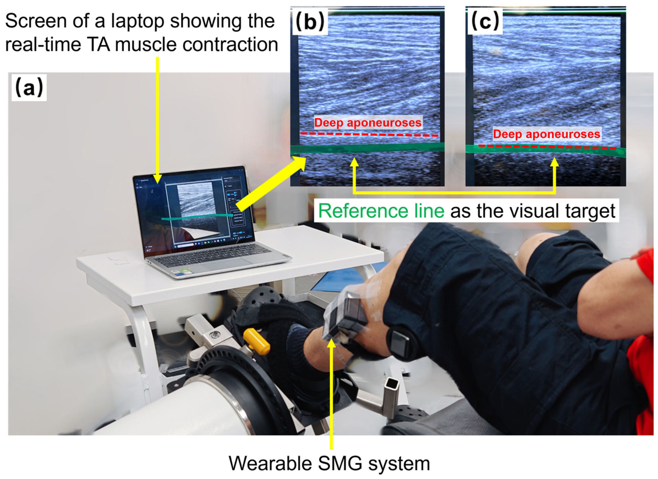 Biosensors 15 00365 g001