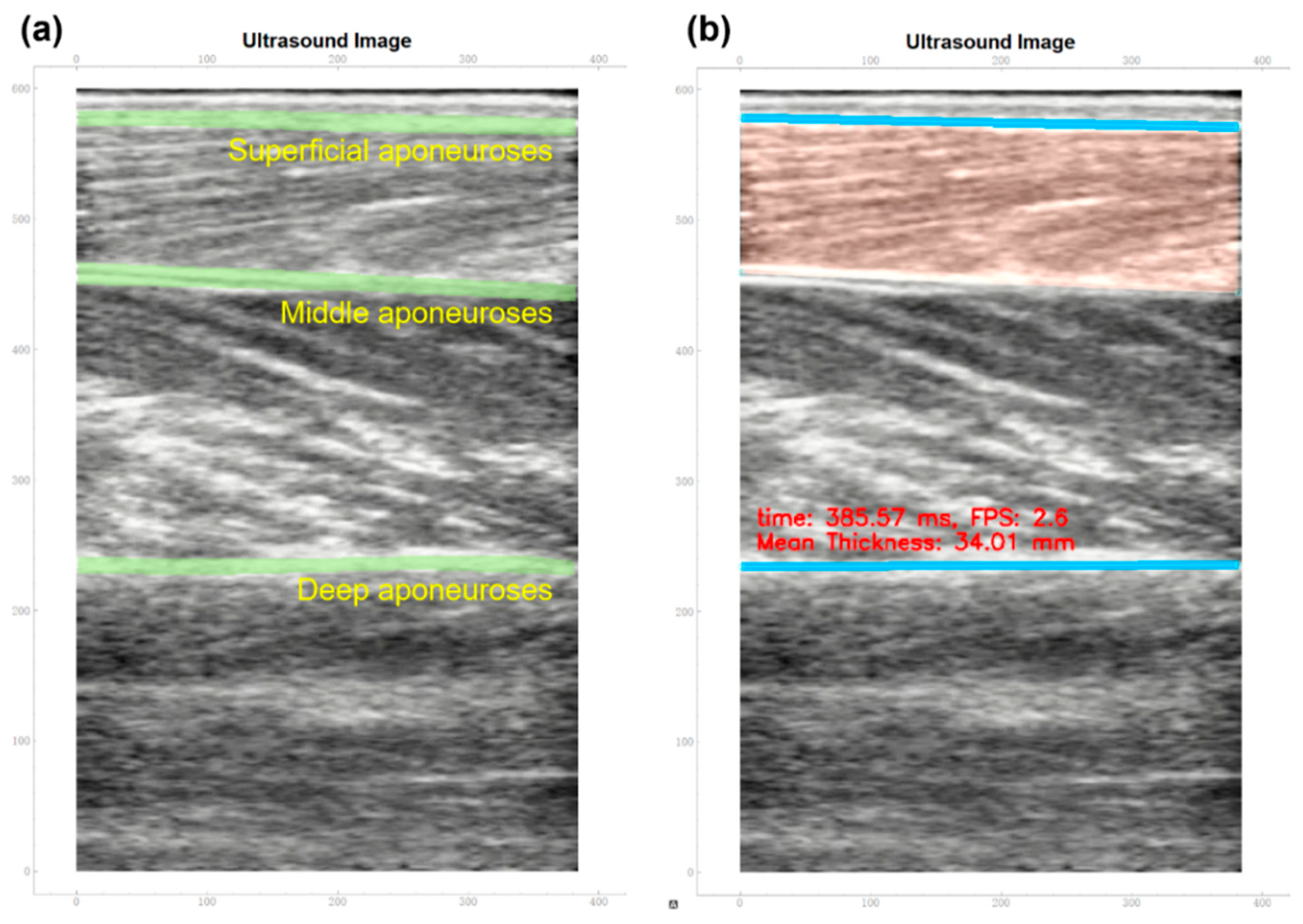 Biosensors 15 00365 g002
