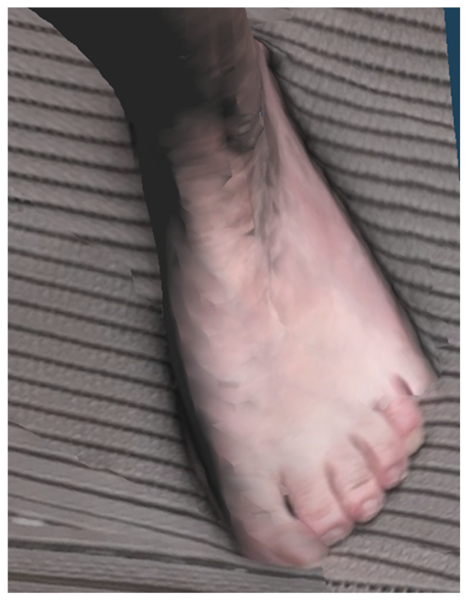 Biosensors 15 00381 g006