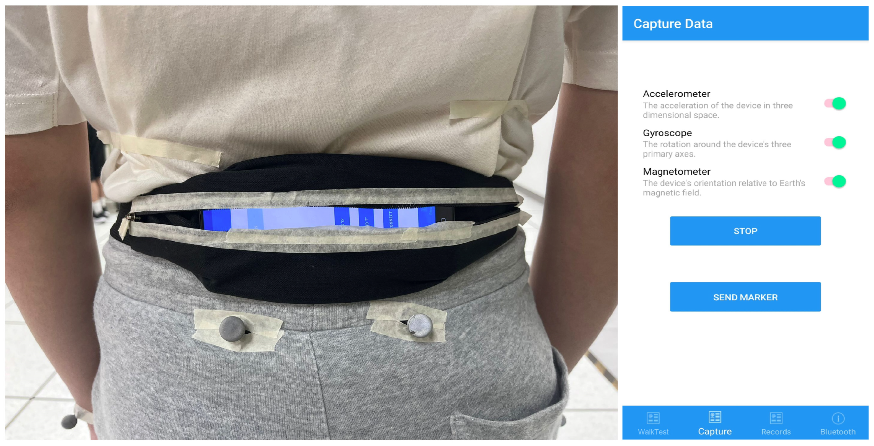 Biosensors 15 00397 g001