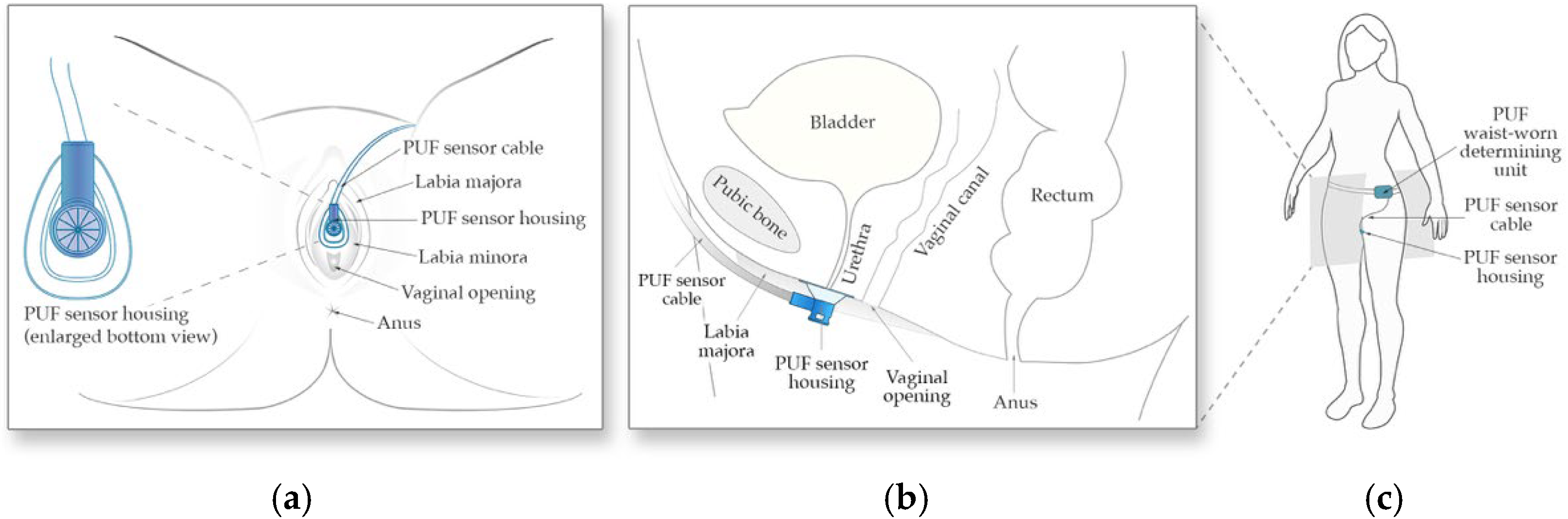 Biosensors 15 00481 g001