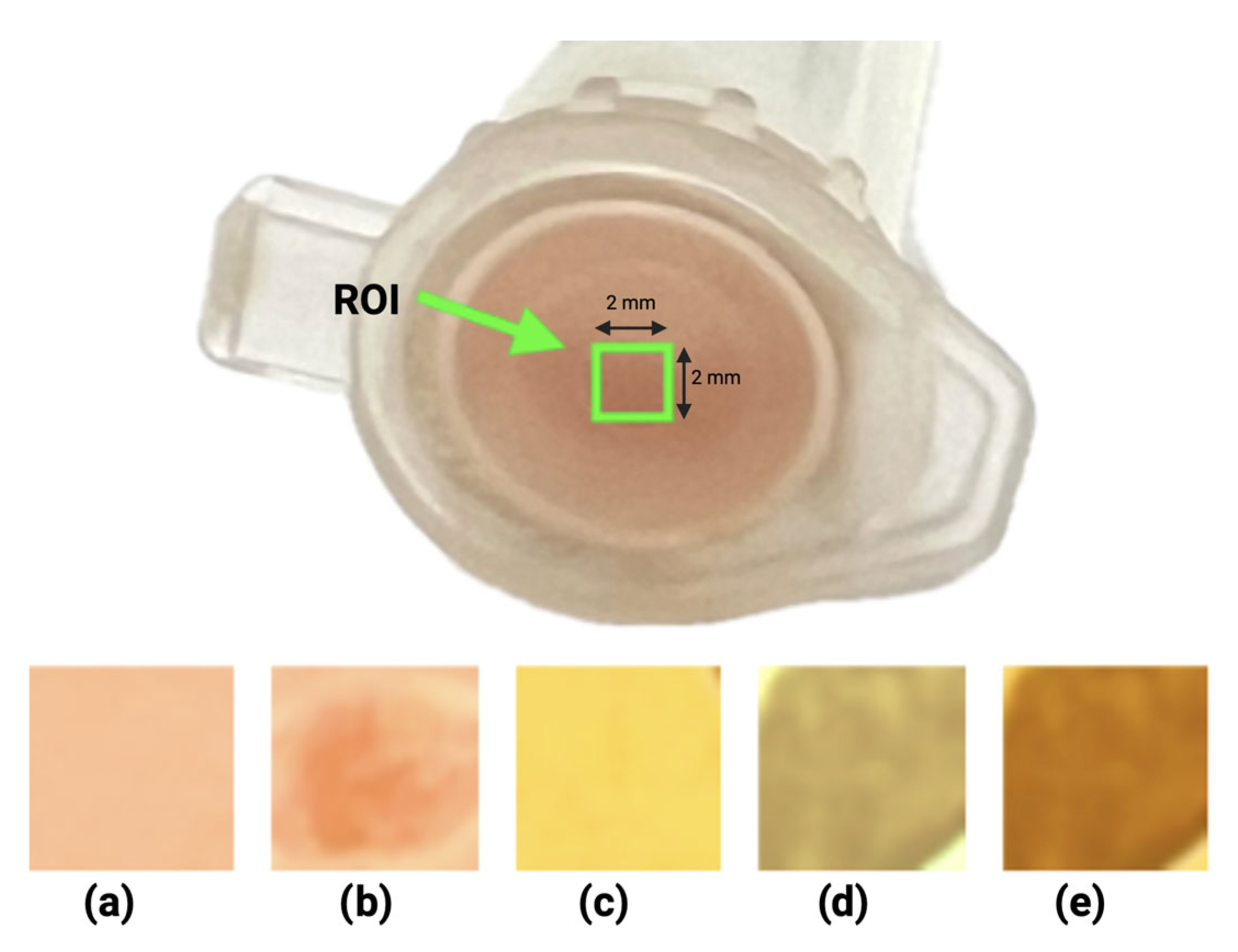 Biosensors 15 00551 g006