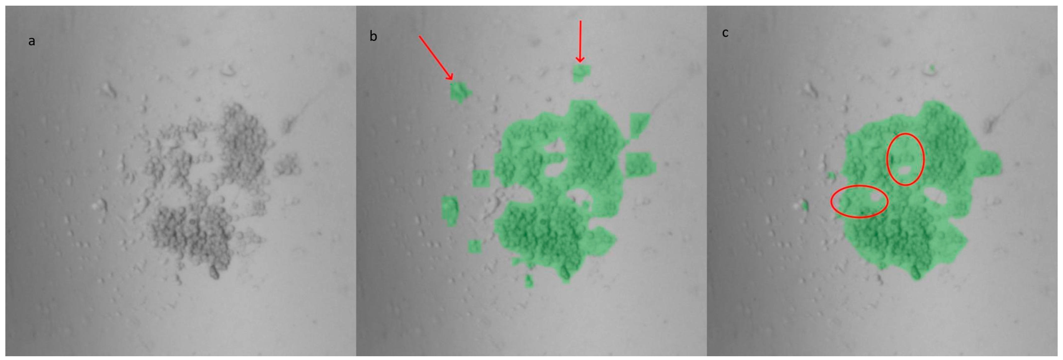 Biosensors 15 00693 g003 Biosensors 15 00693 g003