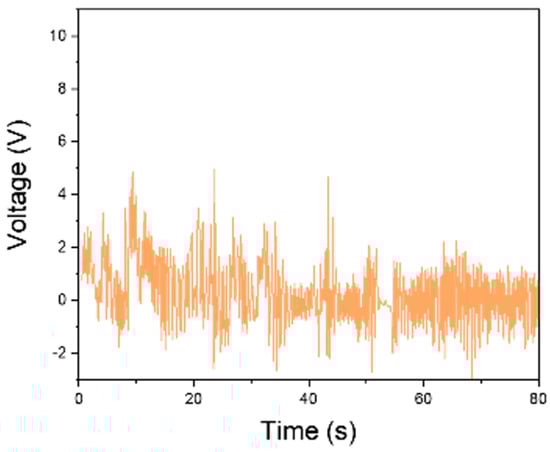 Biosensors 15 00805 g0a14