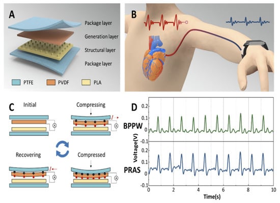 Wearable Sensors for Health Monitoring | MDPI