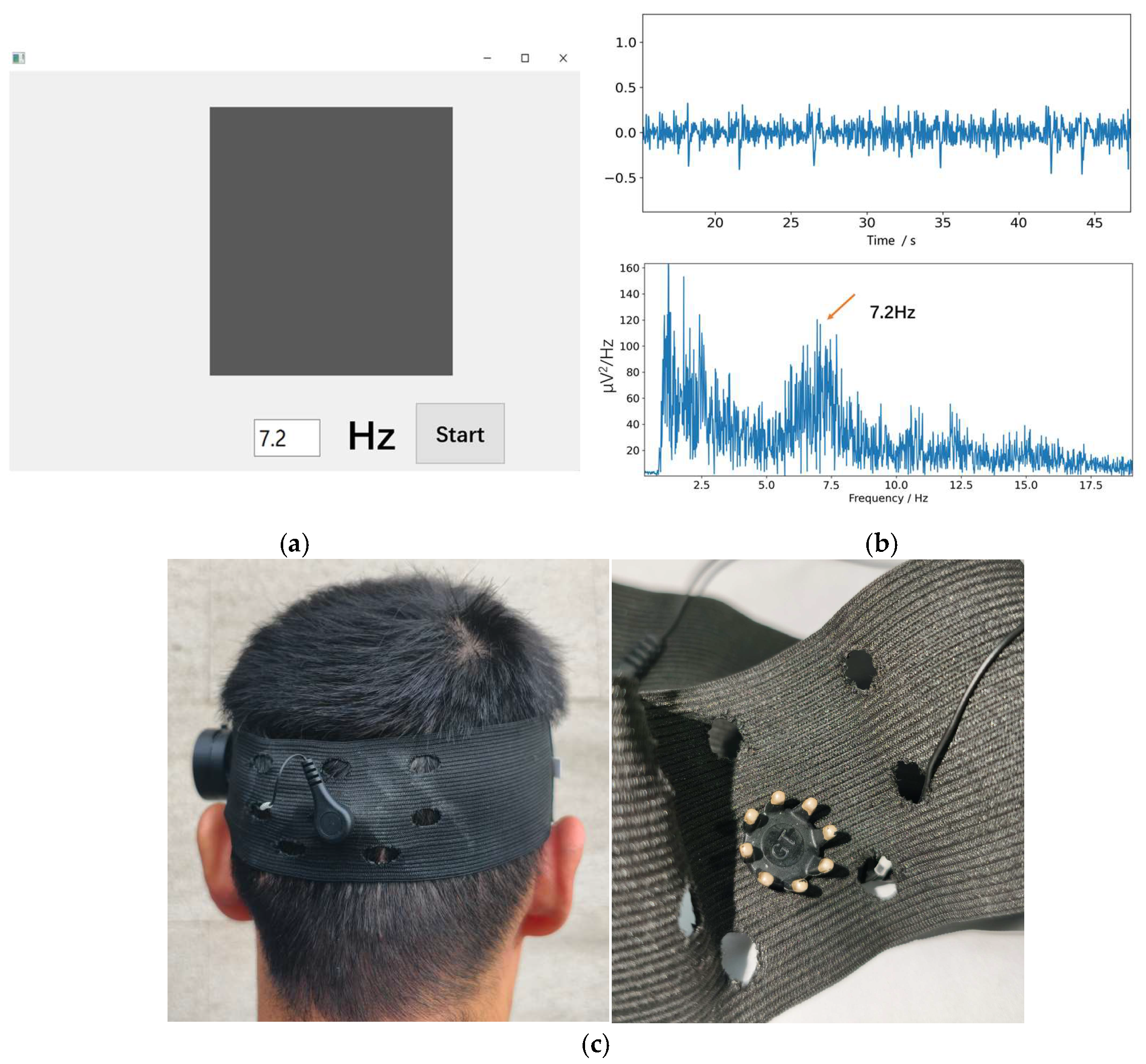 Biosensors 16 00478 g011