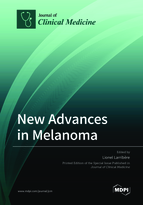 Special issue New Advances in Melanoma book cover image