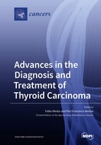 Advances in the Diagnosis and Treatment of Thyroid Carcinoma