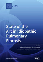 Special issue State of the Art in Idiopathic Pulmonary Fibrosis book cover image