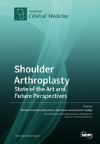 Shoulder Arthroplasty: State of the Art and Future Perspectives
