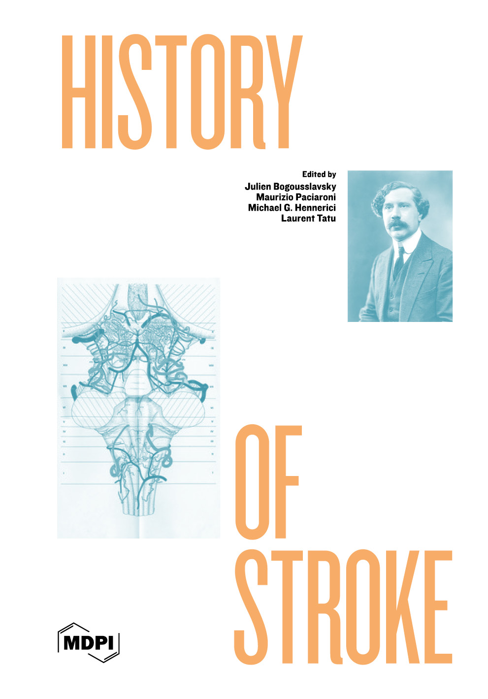 History of Stroke