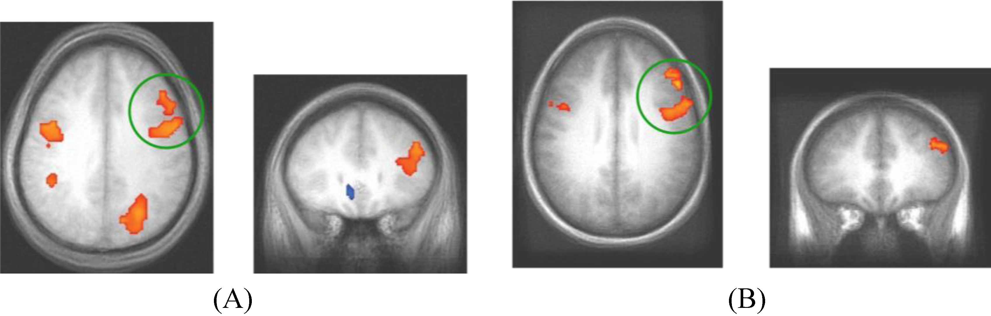 Brainsci 02 00176 g005