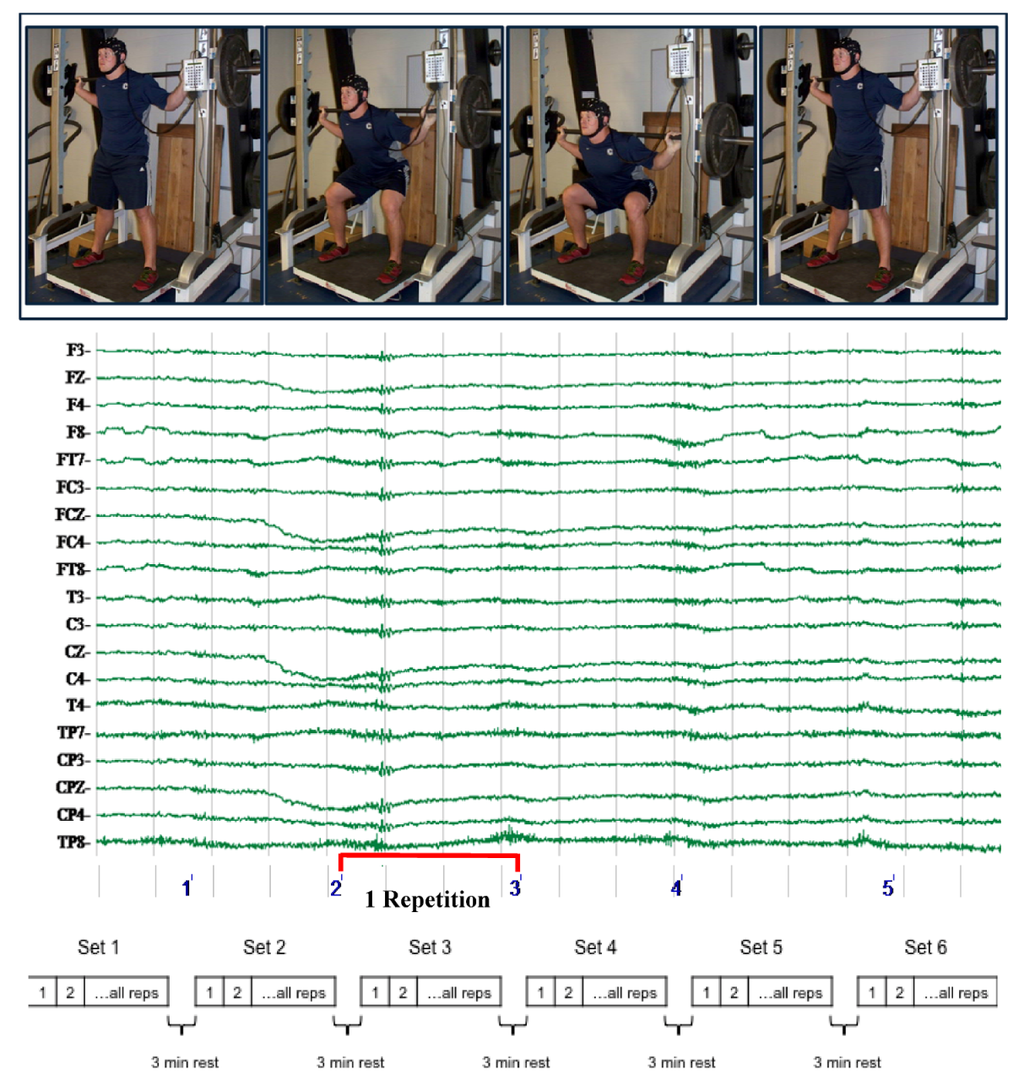 Brainsci 02 00649 g004 1024