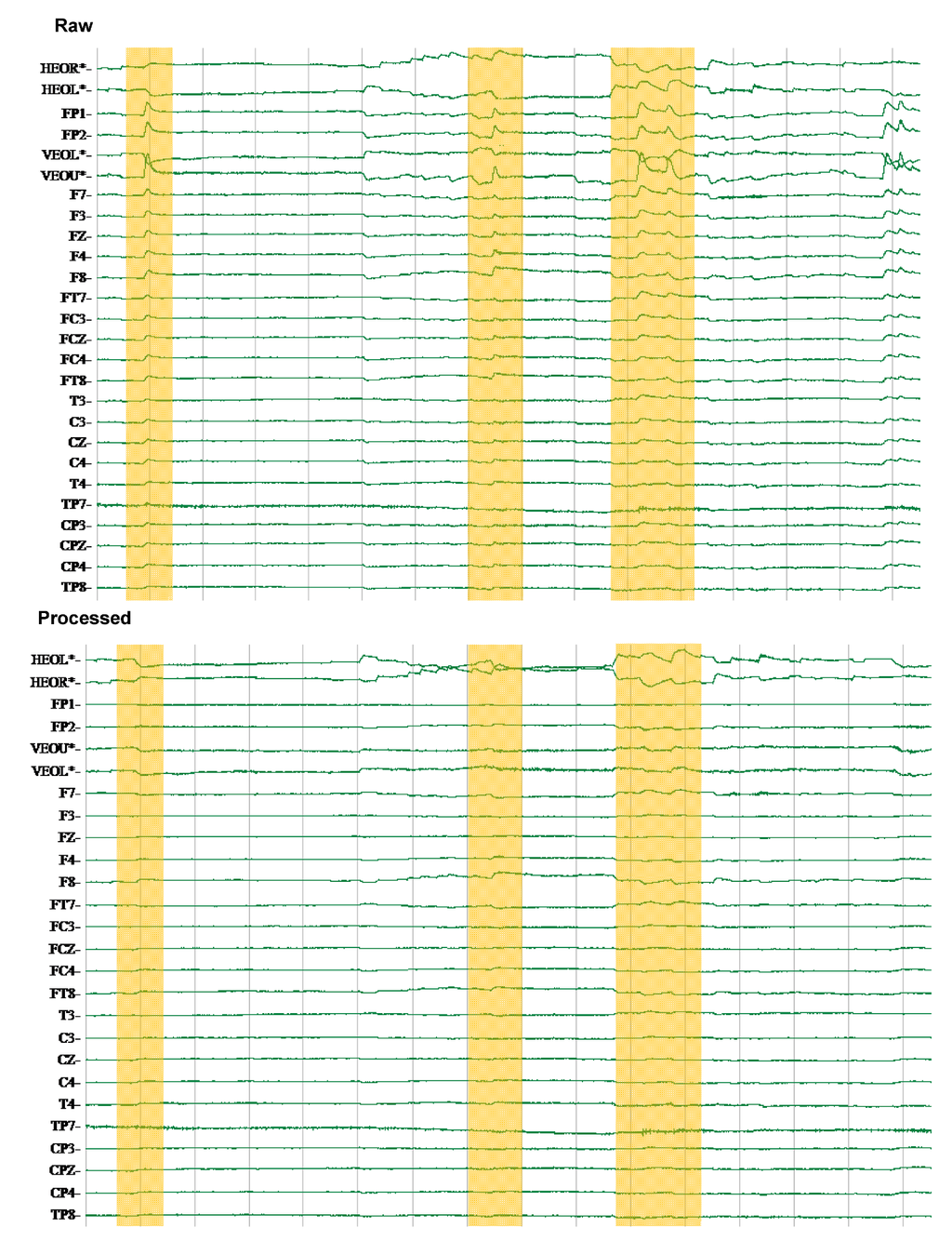 Brainsci 02 00649 g005 1024
