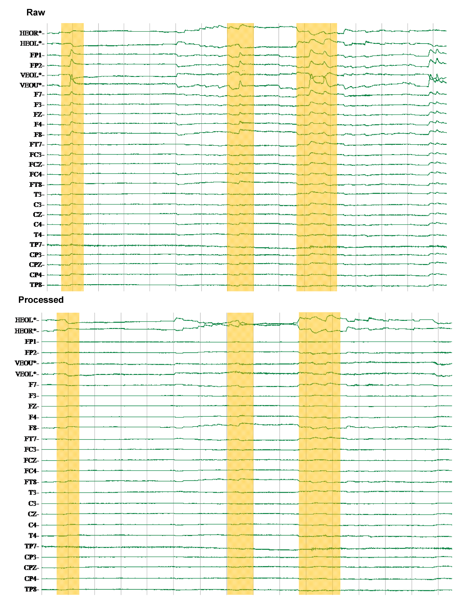 Brainsci 02 00649 g005