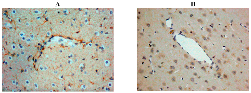 Brainsci 03 00123 g002 1024