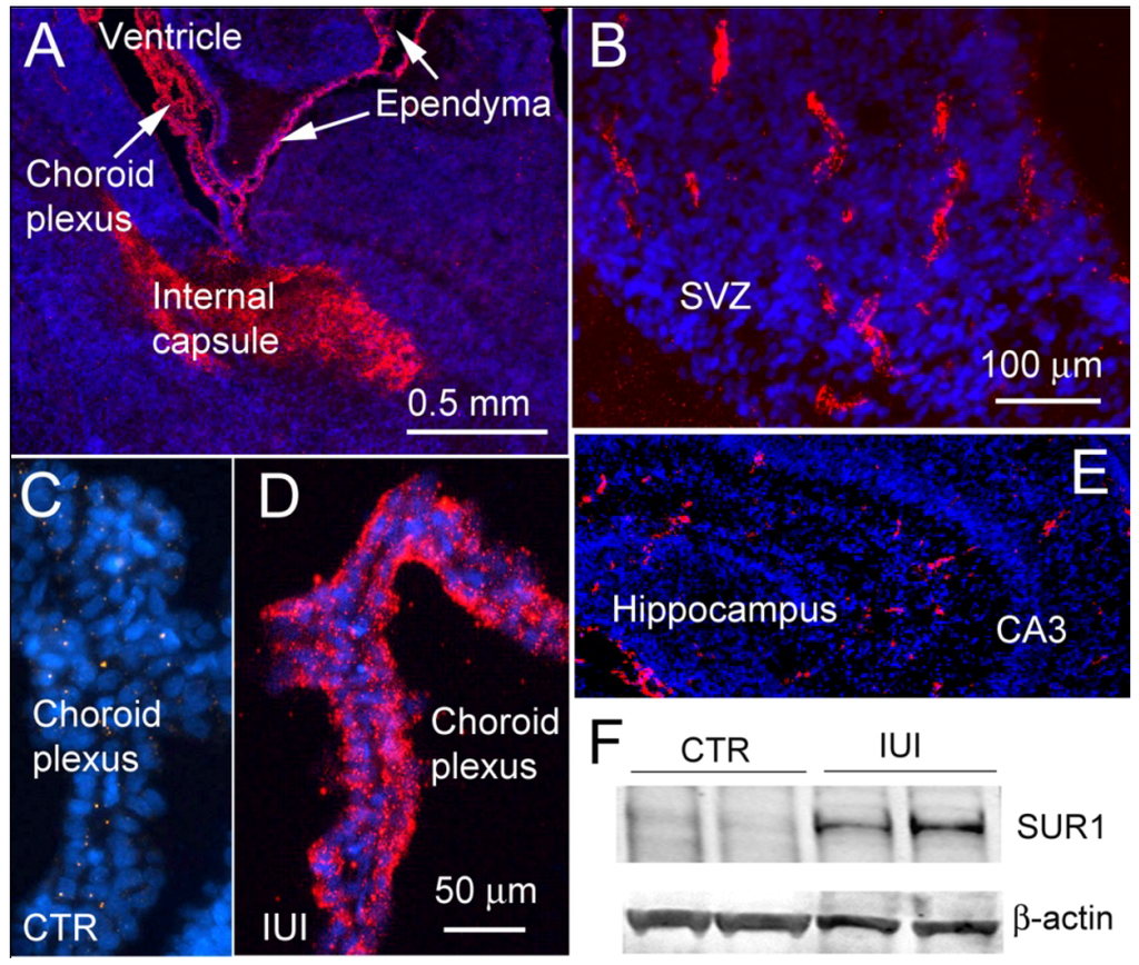 Brainsci 03 00215 g001 1024