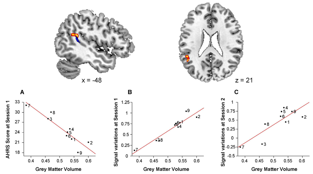 Brainsci 03 00728 g004 1024