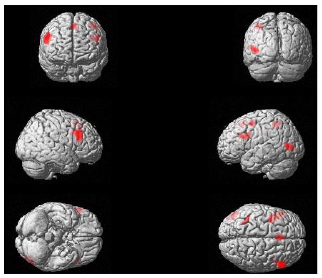 Brainsci 03 01198 g001 1024