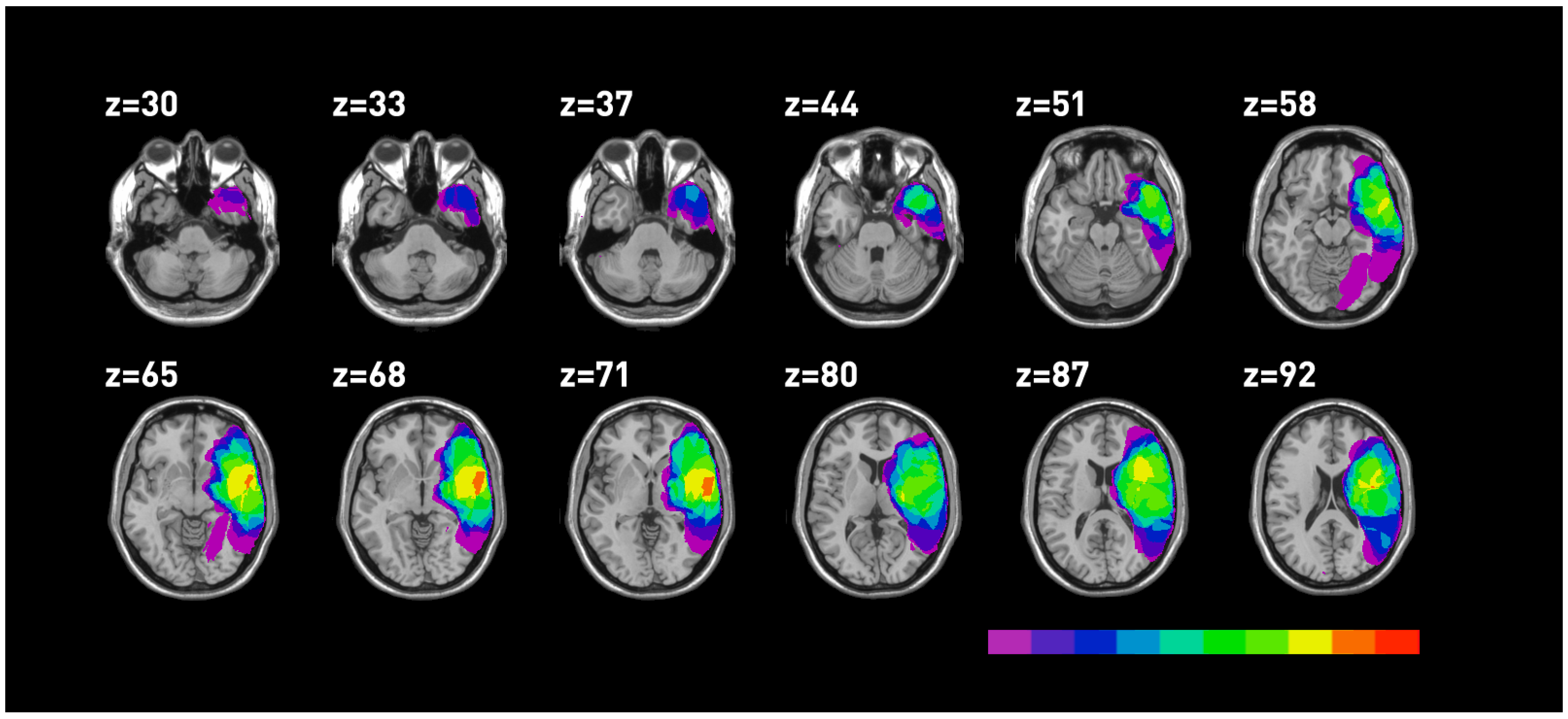 Brainsci 03 01229 g003