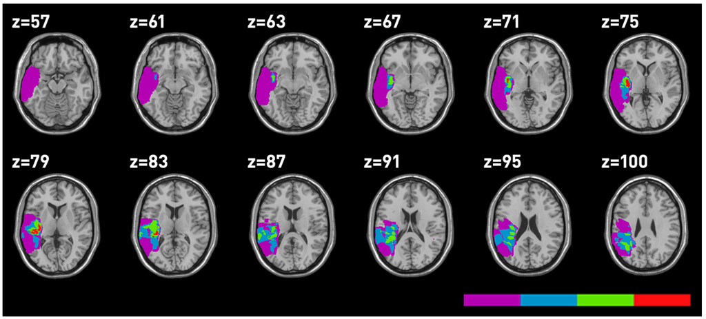 Brainsci 03 01229 g004 1024