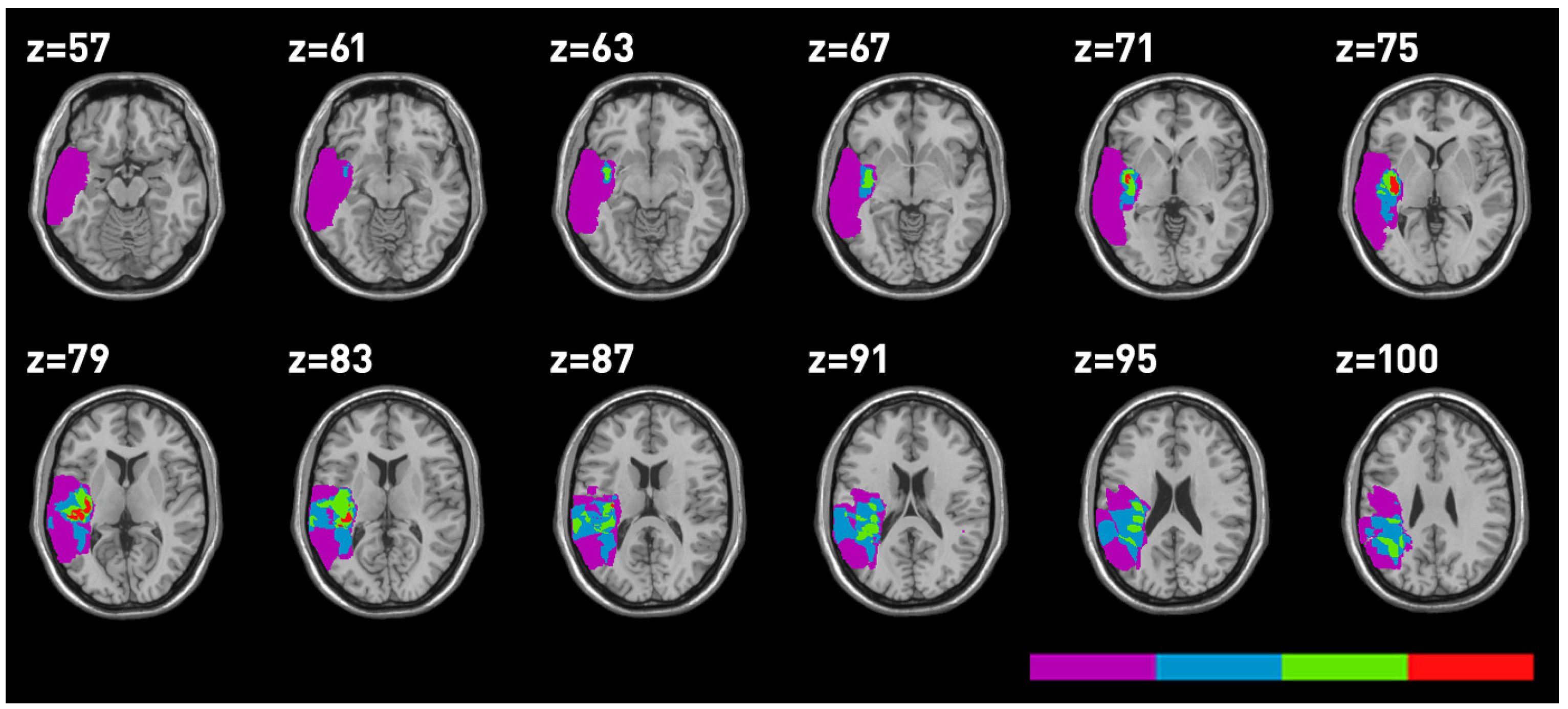 Brainsci 03 01229 g004