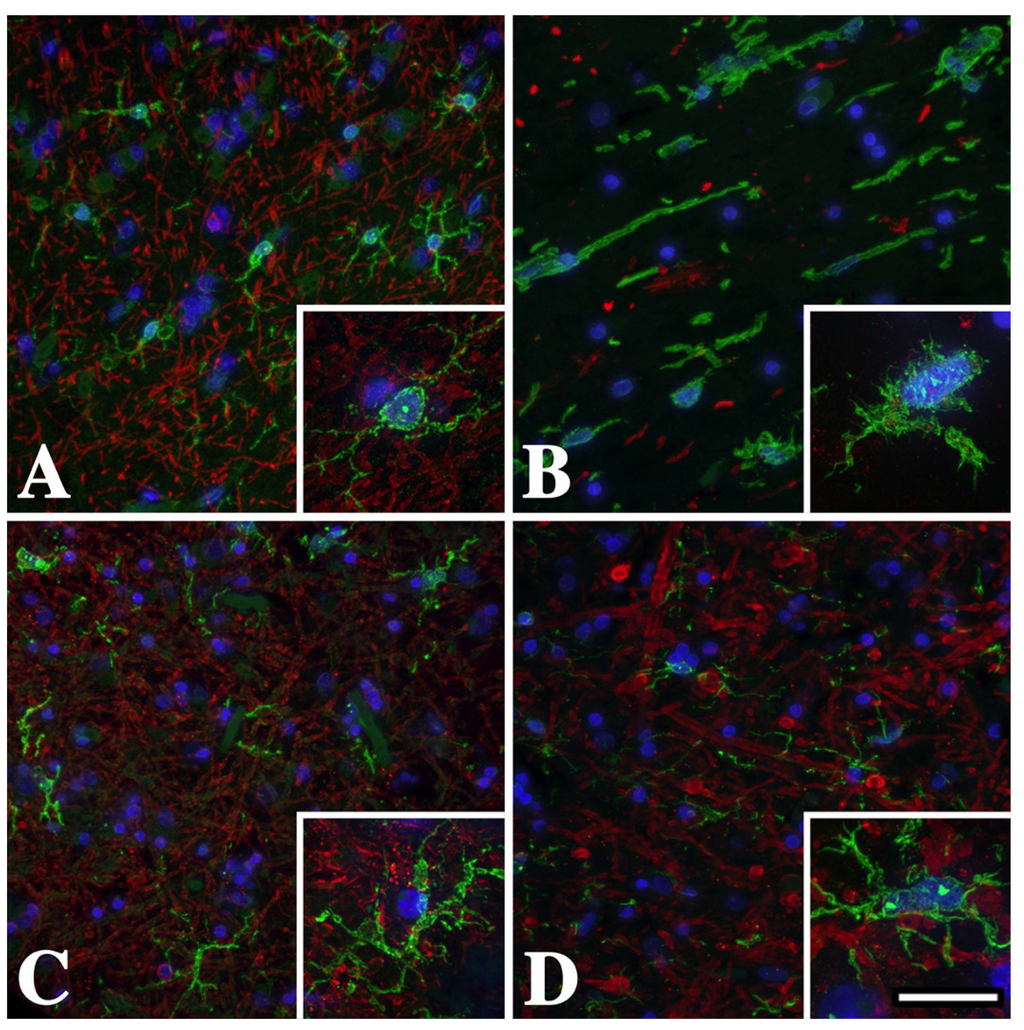 Brainsci 03 01417 g001 1024