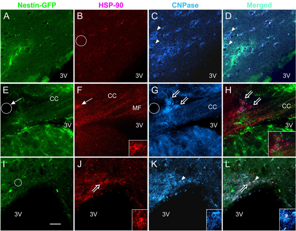 Brainsci 03 01461 g006 1024