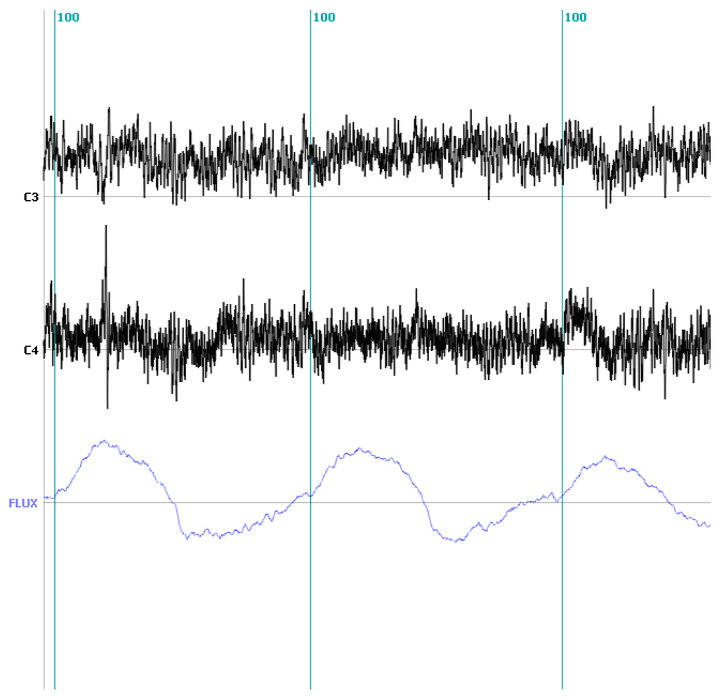 Brainsci 03 01554 g003 1024